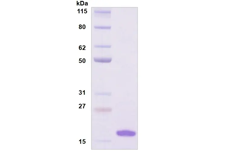 Recombinant Human Siglec-7, His Tag -25 ug